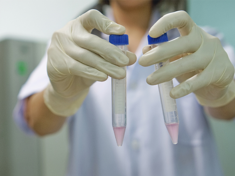 Centrifuge Tubes Centrifuge Tubes